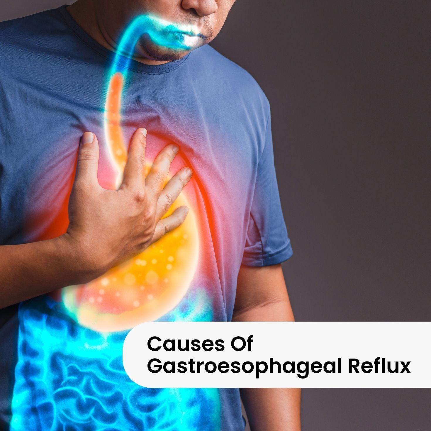 Causes Of Gastroesophageal Reflux